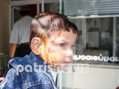 Πύργος: «Ο πρώην εργοδότης μου έλουσε με...