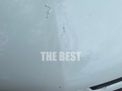 Πάτρα: Της έριξαν καυστικό υγρό στο αμάξι- ΦΩΤΟ