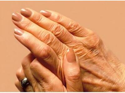 Ενημερωτική εκδήλωση από τον Σύλλογος Ρε...