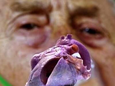 Η καρδιά δεν «πουλάει», το «φαΐ» είναι σ...