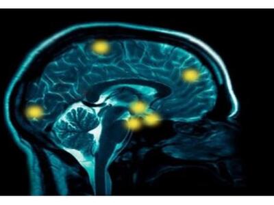 Αλτσχάιμερ: Εγκαιρη πρόβλεψη με μια εξέτ...