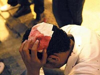 Ηλεία: Εκτός κινδύνου ο Αιγύπτιος που έπ...