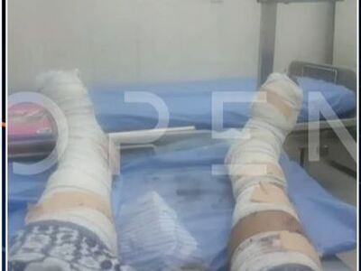 Σουδάν: Φωτογραφία του τραυματισμένου Έλ...