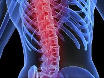 Διατροφή για πρόληψη της οστεοπόρωσης