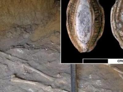 Η αρχαιότερη γνωστή περίπτωση μεταστατικ...