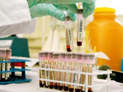 Εναν... Ξένο στο ντόπινγκ αναζητεί ο WADA