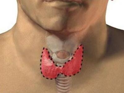 Πάτρα: Νοσήματα του Θυρεοειδούς Αδένα: Α...