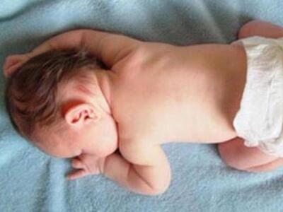 Το «γονίδιο της γιαγιάς» αυξάνει το βάρο...