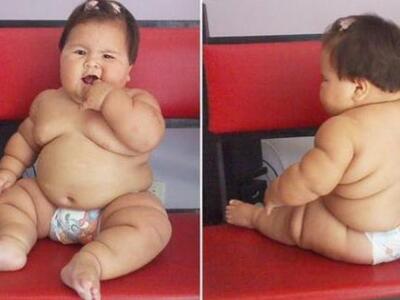 Αυτό το βρέφος, ζυγίζει όσο ένα παιδί  5 ετών
