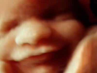 Έμβρυο χαμογελά μέσα στη μήτρα-ΦΩΤΟ