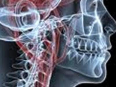 Τα εγκεφαλικά «κτυπούν» όλο και πιο νέου...