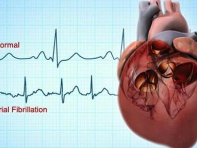 Το Botox προλαμβάνει την κολπική μαρμαρυ...