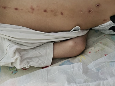 Καραμανδάνειο: Τι λέει ο πατέρας του 7χρ...