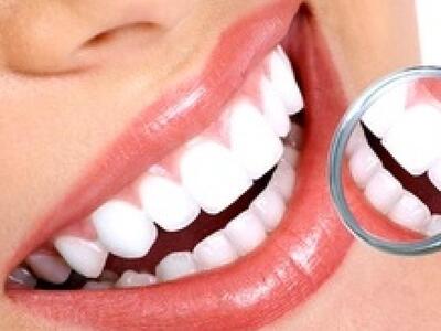 Οδοντιατρική Λεύκανση με τη χρήση Laser!