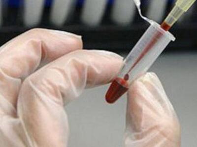 Ερχεται το «τεστ του θανάτου» -Πώς προβλ...