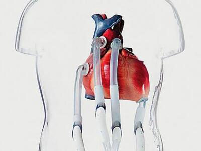 Ανυπομονεί να πάρει εξιτήριο ο πρώτος άν...