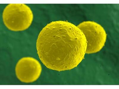 Ο καρκίνος του πνεύμονα μπορεί να παραμε...