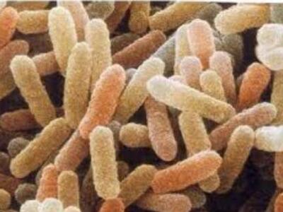 Πάτρα: Ενημέρωση για τα σεξουαλικώς μετα...