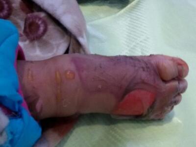 Φωτογραφία "γροθιά στο στομάχι&quot...