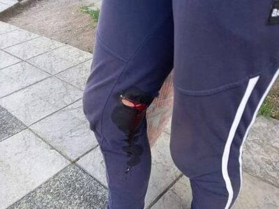 Αγρίνιο: Σκύλος επιτέθηκε σε γυναίκα που...