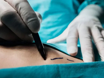 40χρονη κατήγγειλε ινστιτούτο αισθητικής...