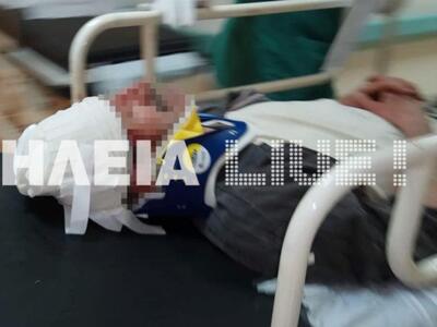 Πύργος: Χτύπησαν με αξίνα στο κεφάλι τον...