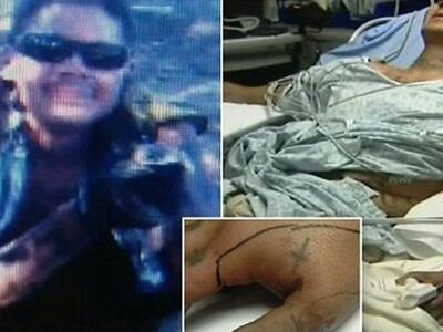 Η.Π.Α.: Πήγε να βγάλει selfie με κροταλί...