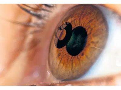 Απίστευτο! Δημιούργησαν κερατοειδή χιτών...