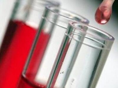 Κύπρος: Στην παγκόσμια αγορά τεστ για πρ...