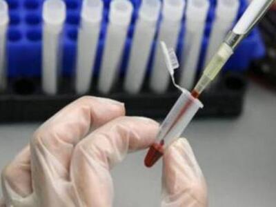 Νέα εξέταση αίματος προβλέπει τον καρκίν...