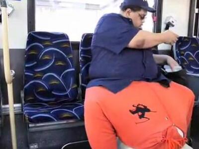  Πέθανε ο άνδρας που είχε αφαιρέσει 60 κιλά όρχι!