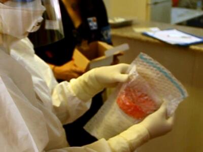 Νέο ταχύτατο αιματολογικό τεστ Έμπολα
