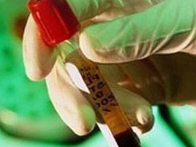 Από ηπατίτιδα B ή C πάσχουν 400.000 Έλληνες 