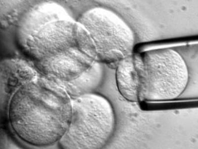 Ανθρώπινα εμβρυϊκά βλαστοκύτταρα θεράπευ...