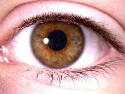 Μάθετε τους παράγοντες γήρανσης των ματιών 