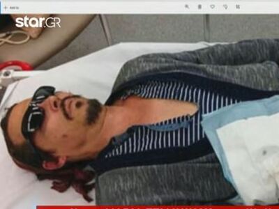 Ο Johnny Depp ματωμένος και καμένος μετά...