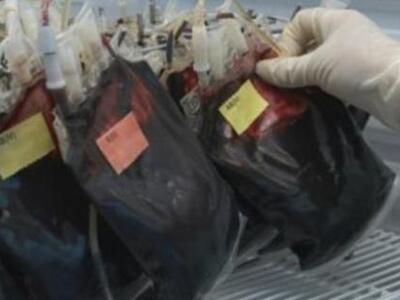 Νέο τεστ αίματος «εντοπίζει» μόλυνση από μύκητες