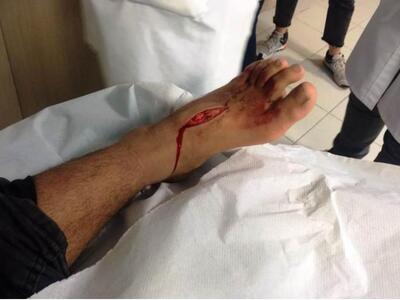 Πάτρα: Σε εξέλιξη αυτή την ώρα η ΕΔΕ για...