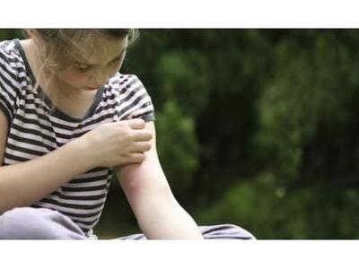 Πως να προστατέψετε τα παιδιά από τα κουνούπια