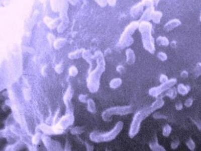 Η φλεγμονή στον προστάτη μειώνει τον κίν...