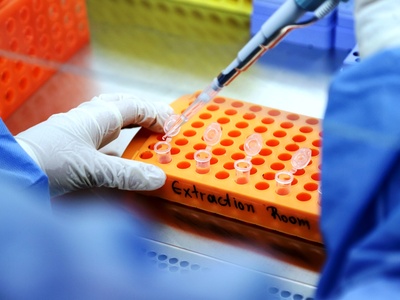 Μεσολόγγι: Υπάλληλος της Περιφέρειας θετ...