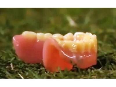 Ηλικιωμένη ξέχασε στο παραβάν...τη μασέλ...