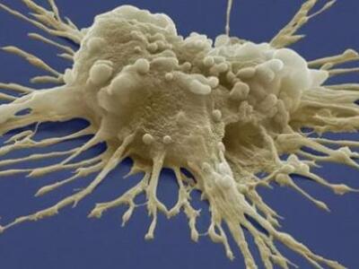 Επιστήμονες «επανεκκίνησαν» βλαστοκύτταρ...