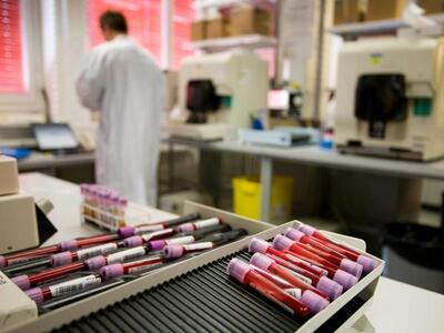 Σουπερ Λίγκα: Θετικός σε χρήση απαγορευμ...