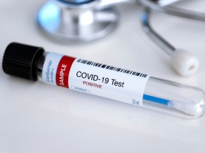 ΕΟΔΥ: Έντονα αυξητική τάση στο ιϊκό φορτ...