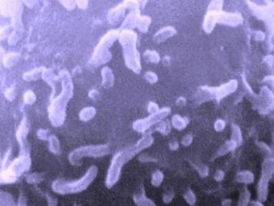 ΠΟΥ: Ο κόσμος μας αντιμετωπίζει τσουνάμι καρκίνων