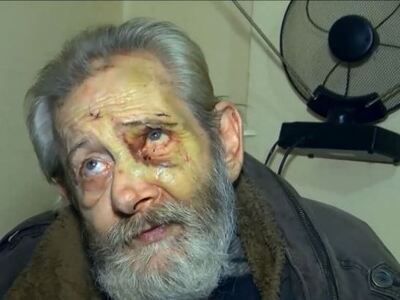 Αδίστακτοι ληστές βασάνισαν χωρίς έλεος ...