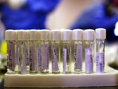 Αχαΐα: Πού θα γίνουν την Πέμπτη δωρεάν rapid tests