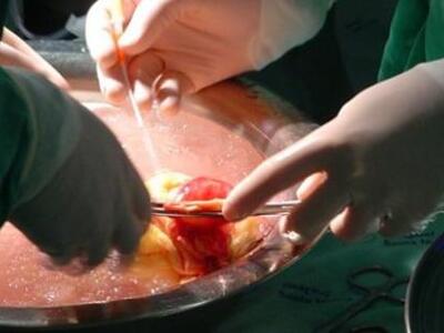 Ζωή σε έξι ανθρώπους σε Ελλάδα και Ιταλί...