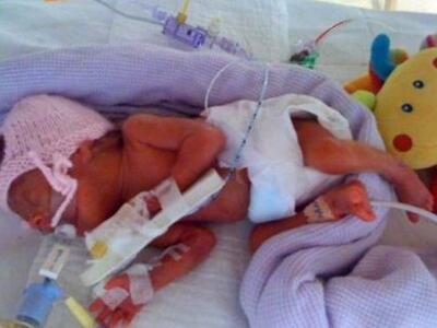 ΔΕΙΤΕ πως είναι σήμερα οι δίδυμες που γε...